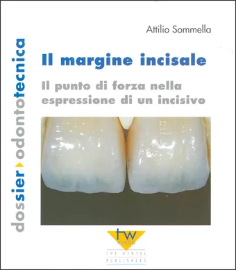 Teamwork Media Il margine incisale libro ceramica 172 pagine