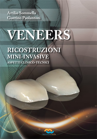 Teamwork Media Veneers ricostruzioni mininvasive libro online