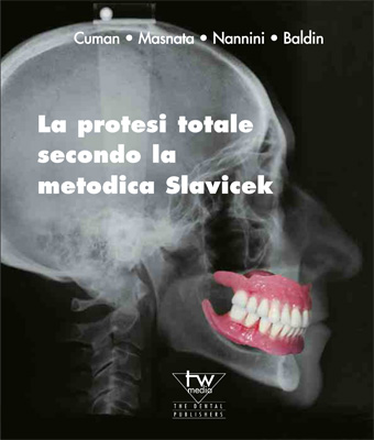 Teamwork Media Protesi totale secondo Slavicek libro online
