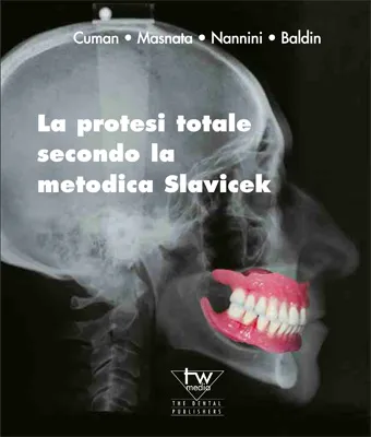 Teamwork Media Protesi totale secondo Slavicek libro online