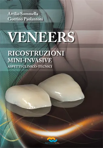Teamwork Media Veneers ricostruzioni mininvasive libro online